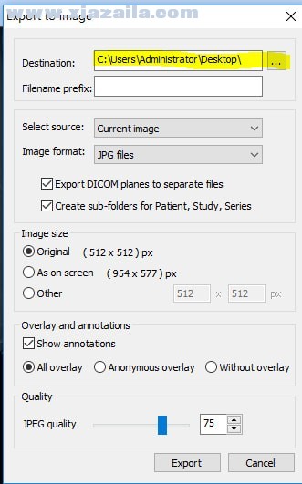 MicroDicom viewer(Dicom格式看图软件) v3.4.7